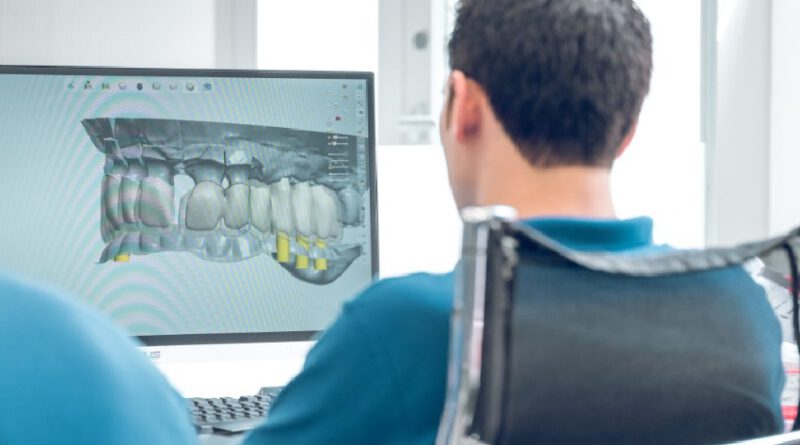 CBCT